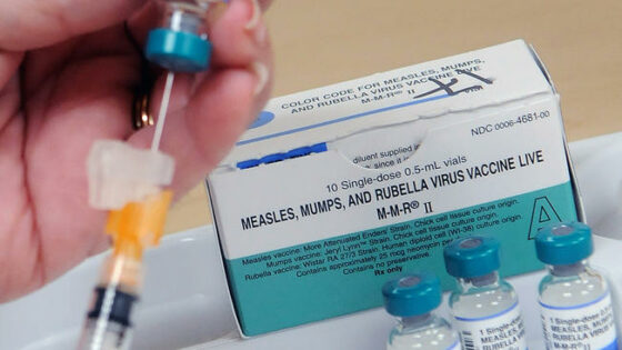 Monsey Measles Outbreak That Sickened 312 In Rockland County Declared Over